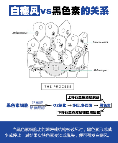 未标题-11.jpg