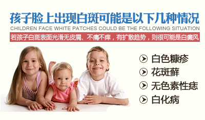 小孩脸上有白斑怎么办 小孩脸上有白斑怎么办